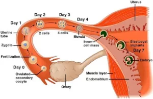 implantation7wb